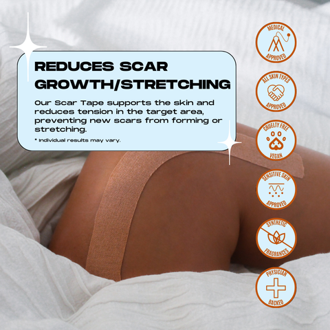 Motivo - Scar Tape 20pcs