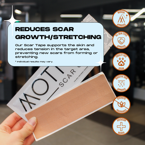 Motivo - Scar Tape - 4pcs