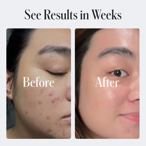 Geologie - Clear Skin Face Cream