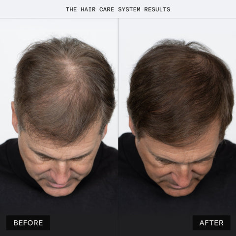 Caldera + Lab - The Hair Care System