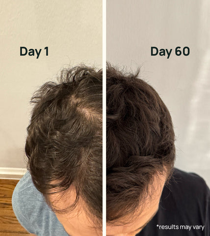 Krete - Hair Thickening Formula