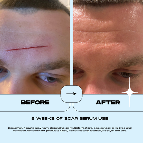 Motivo - Scar Serum
