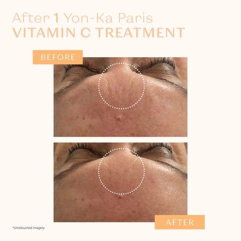 Yon-Ka Paris - Serum Vitamine C