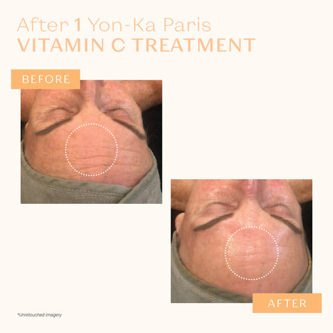 Yon-Ka Paris - Serum Vitamine C